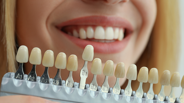 Teeth whitening near me