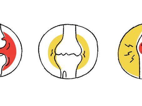 膝の痛みと変形を止めたいなら|荷重軸を3Dで見直す方法