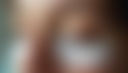 Effective Eye Stye Remedies: How to Treat and Prevent Styes