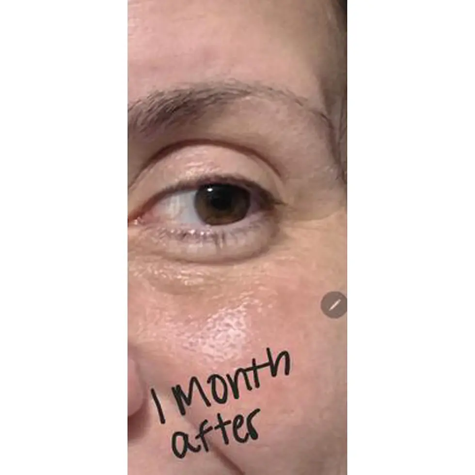 Thumbnail: CeraVe Eye Repair Cream