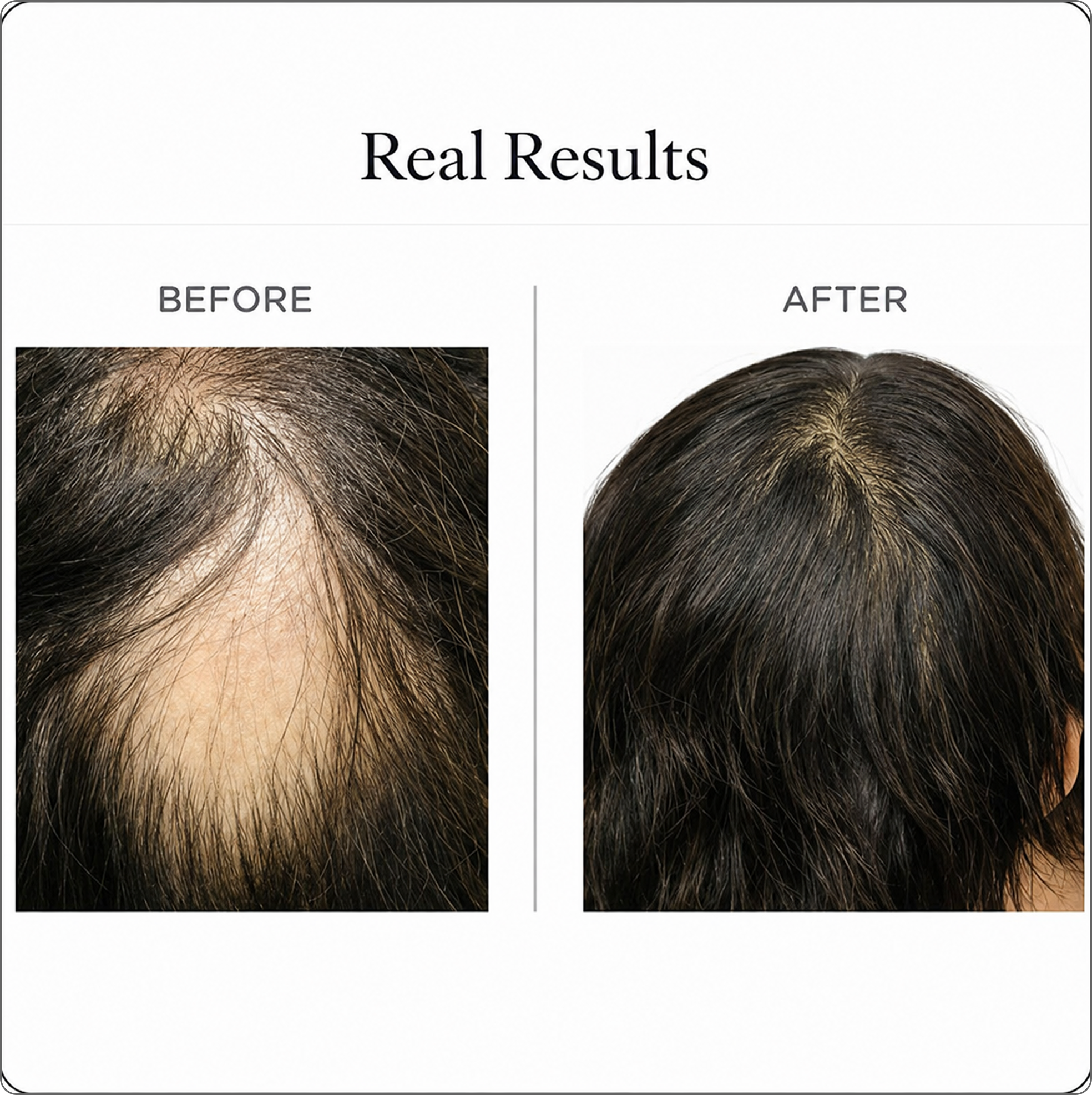 Pre-Hair Wash Nourishment Treatment