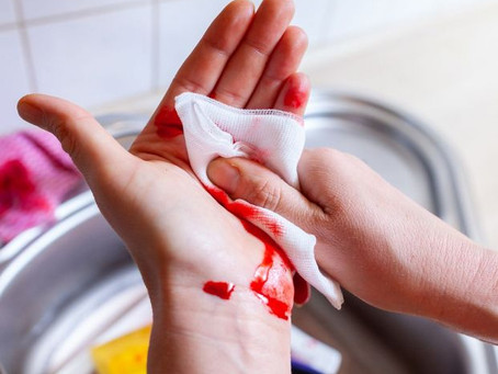 Qué hacer en una emergencia de hemorragia externa.