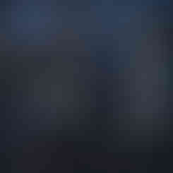 The microphone has an accessible USB port, a headphone jack, a mic gain knob, and a monitoring volume control.