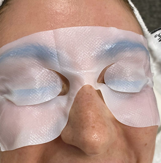 Facial aesthetics treatment