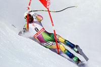 SHOULDER FRACTURES