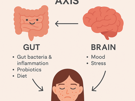 Acne, Gut Health, and Your Mind