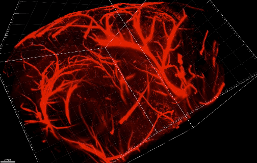 Light sheet microsocopy of whole brain tissues from a disease model of ALS/FTD
