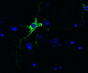 longitudonal micoscopy obseving the accumulation of toxic ALS/FTD-linked protein in C9orf72
