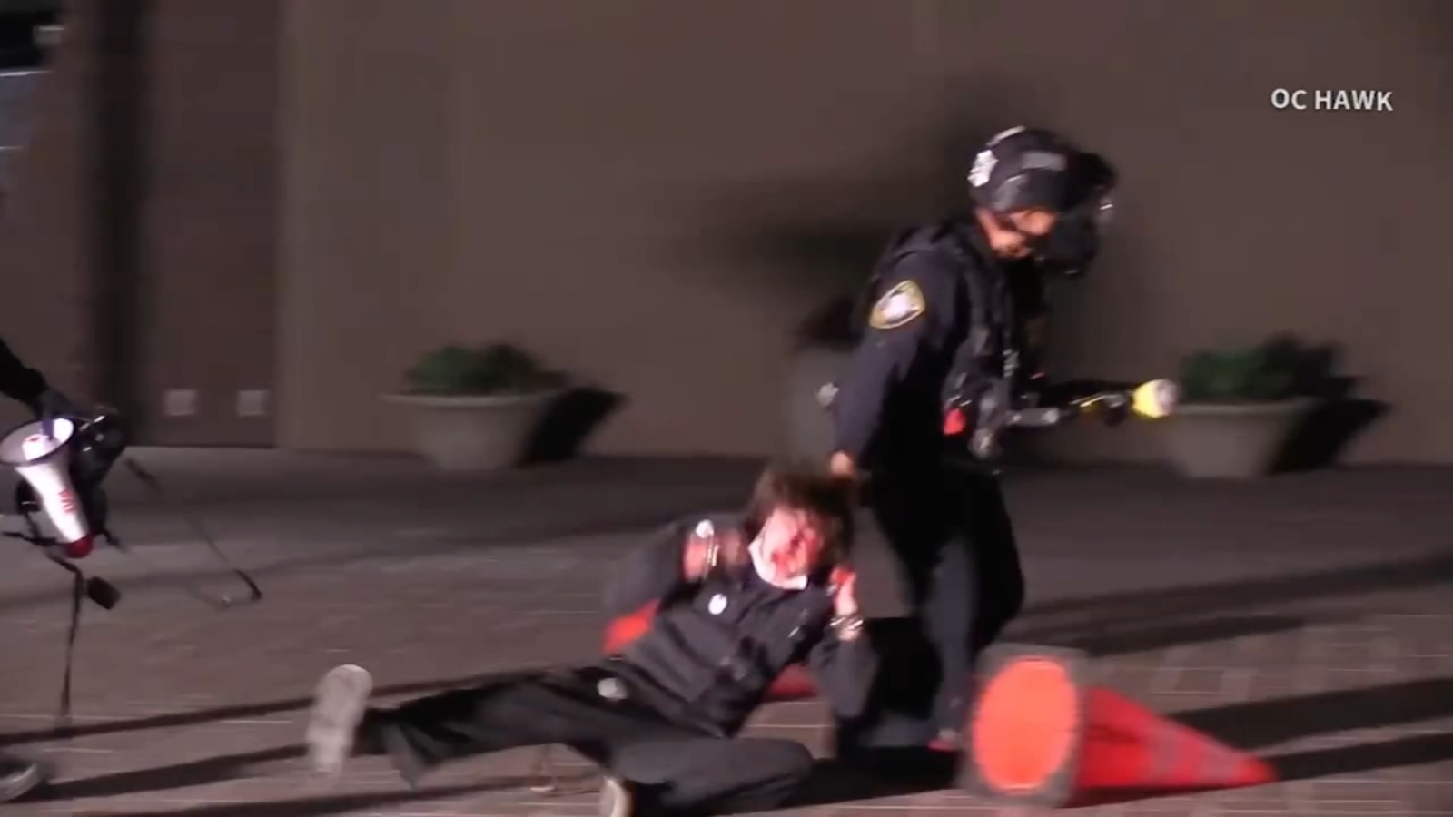 protester_blind_in_left_eye_after_federal_agent_fired_projectile_at_santa_ana_protest_family_says