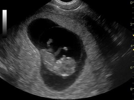 エコーを買いました