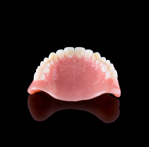 Complete maxillary denture upside down in back view with reflection Color_ A3.jpg