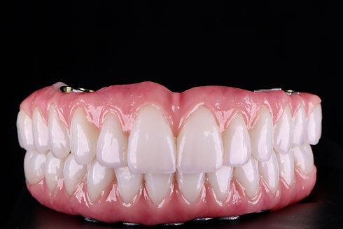 laboratory implants zirconia prosthesis prosthesis protocol.jpg