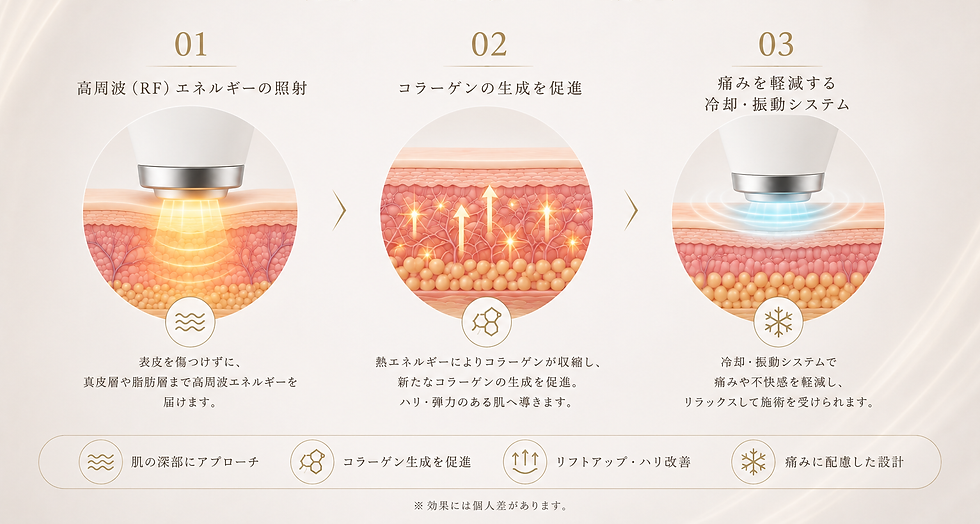 メカニズム.png
