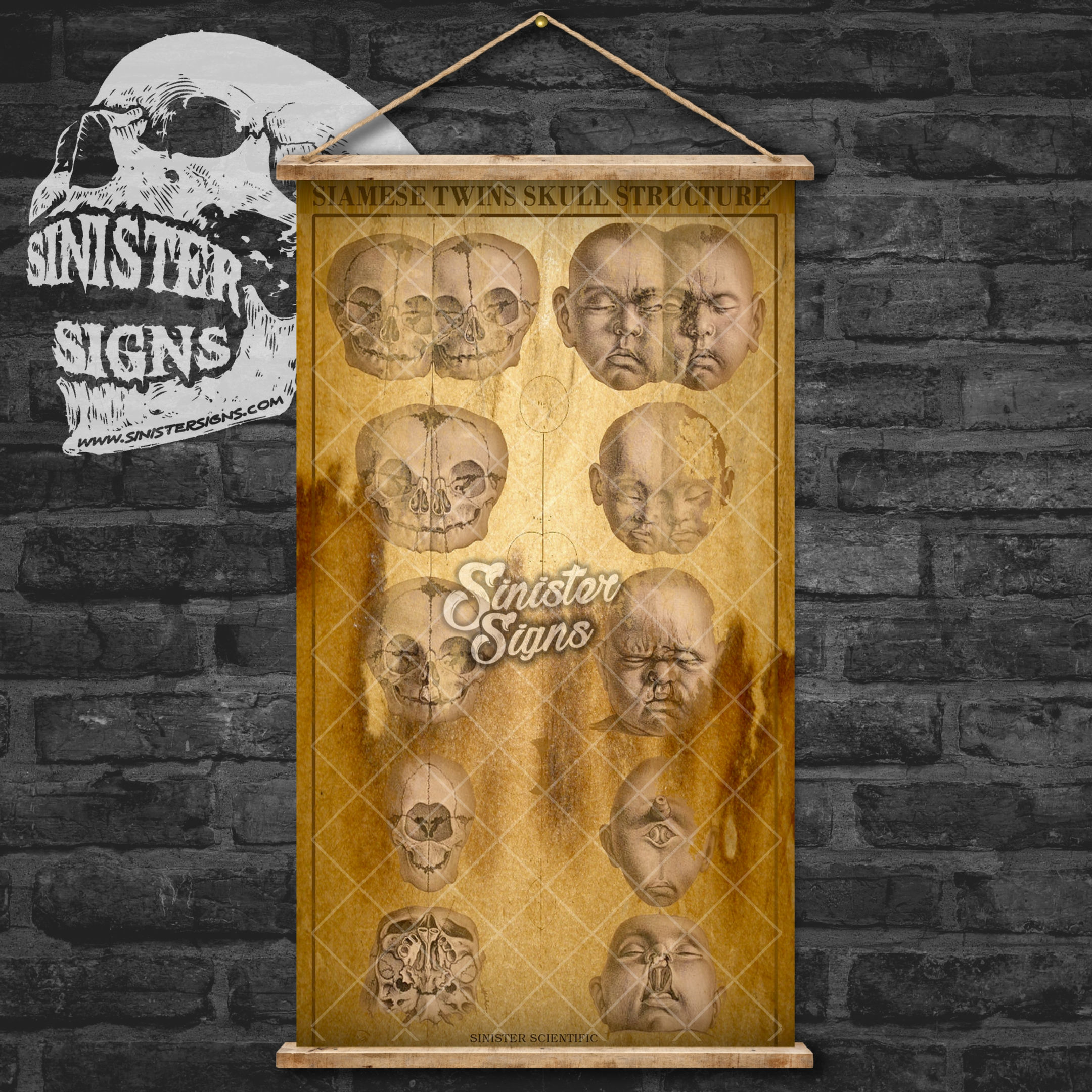 Siamese Twin Skull Structure Wall Hanging