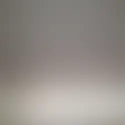 Interior Damage From Roof Leak