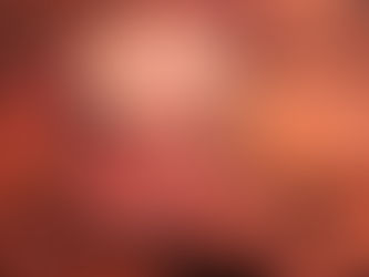 Affordable Non-Surgical Spinal Decompression in Cary, NC