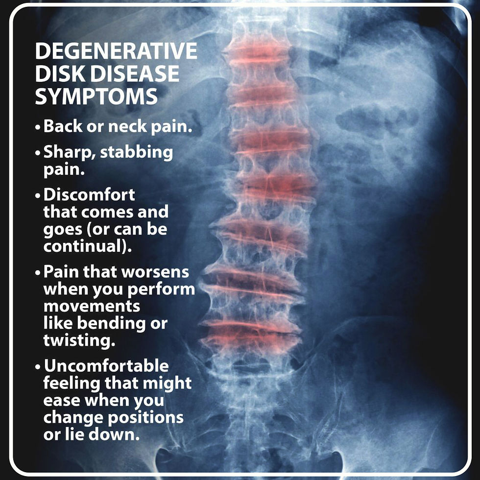 X-ray with profound degenerative changes and descriptions of what these changes feel like to an individual