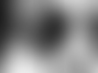 You can always have back surgery, but you can never undo back surgery.