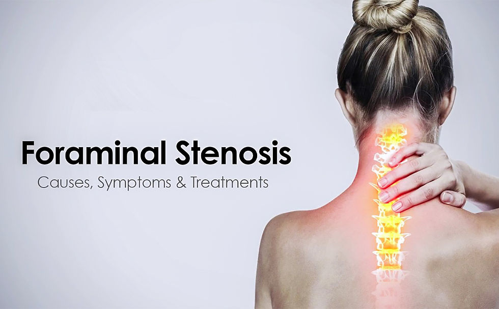 Back view of a woman holding her neck, with highlighted spine area in yellow and red. Text: Foraminal Stenosis: Causes, Symptoms & Treatments.