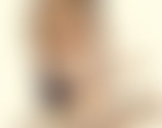 Understanding Adjacent Segment Disease (ASD) After Spinal Fusion Surgery