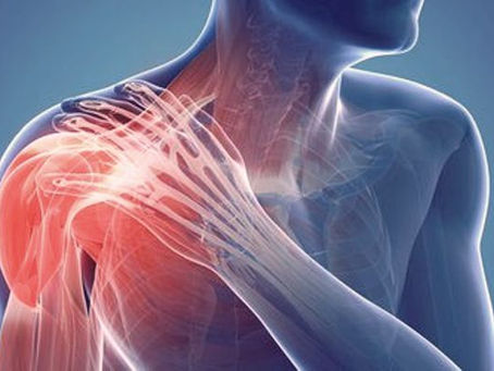 Is Your Neck, Shoulder, or Arm Pain Not Improving? You May Have an Undiagnosed Herniated Disc!