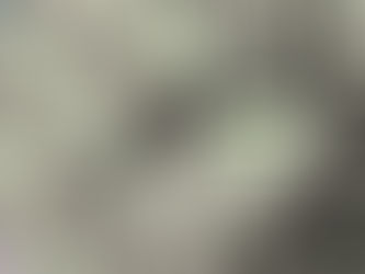 Cost Effective Back Surgery Alternative!