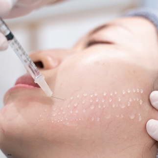Mesotherapy pic.png