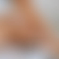 Holistische verwenbehandeling