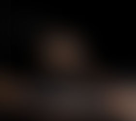 Science fact of the day: Spitting cobras can spray venom over 6 feet