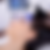 Radiofrequency microneedling in London