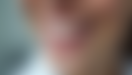 Understanding the Role of a Specialist in Dental Prosthetics