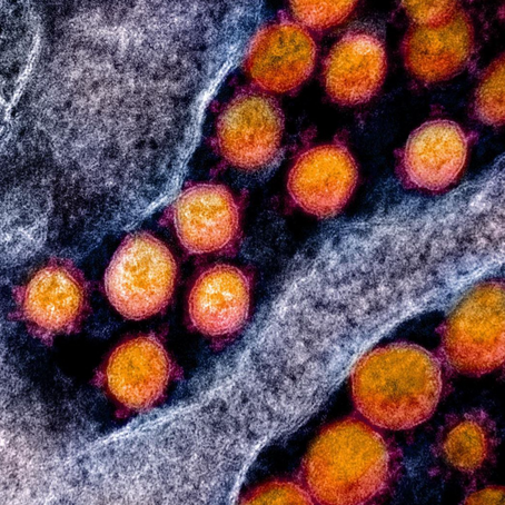 Di Rundung Wabah COVID-19, Tetap Berpikiran Rasional!