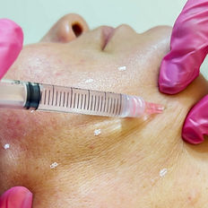 Skin booster