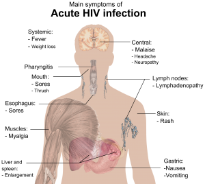acute retro viral syndrome