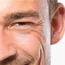 eyes wrinkle .jpg