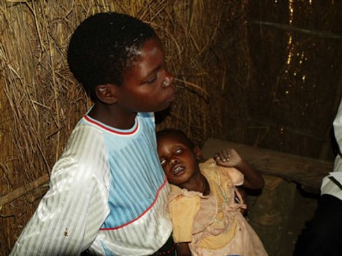 malaria.jpeg