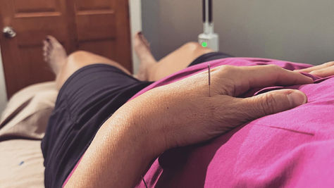 How does acupuncture work?