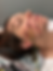 Electrostimulation hooked to acupuncture needles on face for Bell's Palsy treatment
