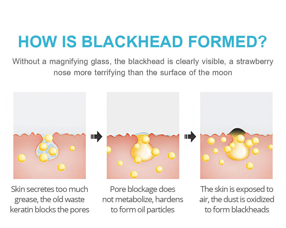 Thumbnail: Charcoal Peel Off Mask (3 Pc)