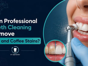Can Professional Teeth Cleaning Remove Tea and Coffee Stains?