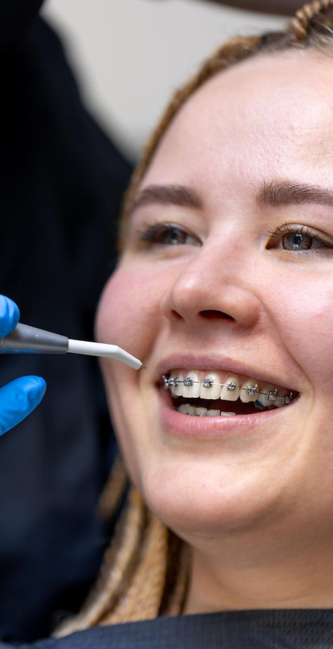 Who Is a Good Candidate for Braces in Himayatnagar