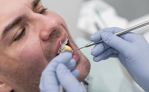 Glass Ionomer Cement (GIC) Fillings