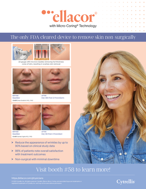 Doctor-facing print ad for ellacor using before and after images showing the skin tightening results.