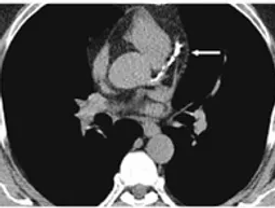 Cardiology consult.webp