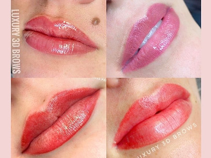 Lip treatment that was performed on four women