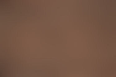 The Oldest Recorded Case of Spinal Cord Injury