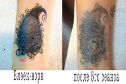 Блек ворк удаление