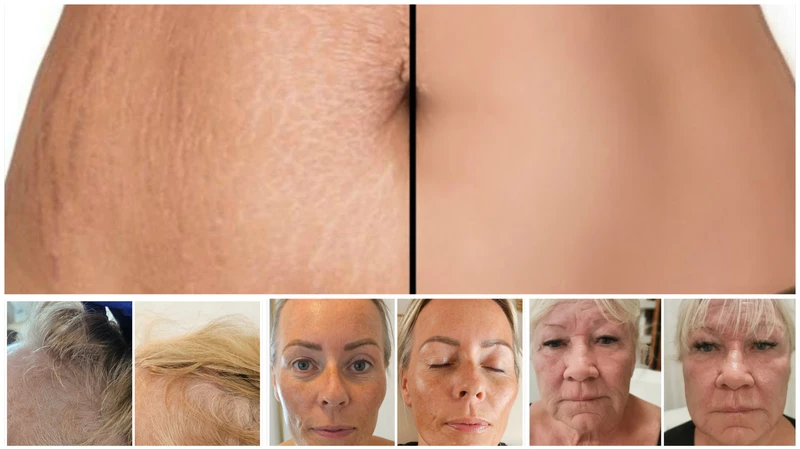 Advanced Microneedling Masterclass
