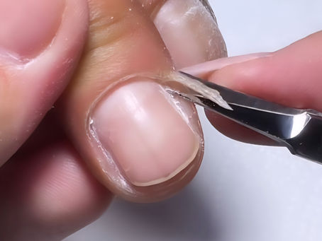 Stop Cutting Lateral Nail Folds! Your Clients’ Nails Are Not Just Dead Skin