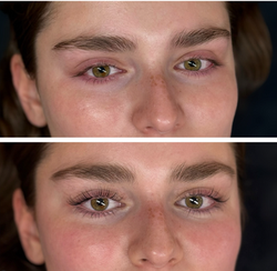 Before and After